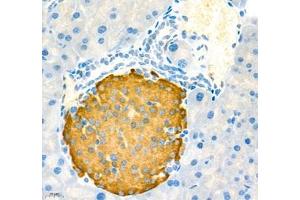 Immunohistochemistry (Paraffin-embedded Sections) (IHC (p)) image for anti-Mucosal Vascular Addressin Cell Adhesion Molecule 1 (MADCAM1) antibody (ABIN7074695)