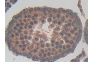Immunohistochemistry (IHC) image for anti-Tubulin, delta 1 (TUBD1) (AA 238-482) antibody (ABIN7439597)