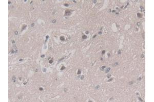 Used in DAB staining on fromalin fixed paraffin-embedded Liver tissue (PGC 抗体  (AA 61-388))