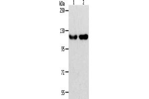 Gel: 8 % SDS-PAGE, Lysate: 40 μg, Lane 1-2: Hela cells, Jurkat cells, Primary antibody: ABIN7189608(ABL2 Antibody) at dilution 1/400, Secondary antibody: Goat anti rabbit IgG at 1/8000 dilution, Exposure time: 2 minutes (ABL2 抗体)
