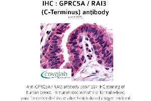 Image no. 1 for anti-G Protein-Coupled Receptor, Family C, Group 5, Member A (GPRC5A) (C-Term) antibody (ABIN1735209)