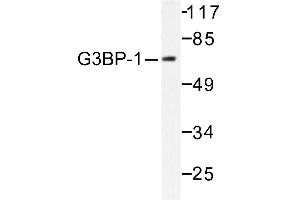 Image no. 1 for anti-GTPase Activating Protein (SH3 Domain) Binding Protein 1 (G3BP1) antibody (ABIN265425) (G3BP1 抗体)