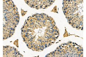ABIN6261222 and ABIN6278199 at 1/100 staining Mouse testis tissue by IHC-P.