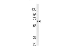 Western Blotting (WB) image for anti-Cytochrome P450, Family 3, Subfamily A, Polypeptide 5 (CYP3A5) (AA 186-218) antibody (ABIN652394)