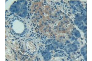 Detection of C1INH in Rat Pancreas Tissue using Polyclonal Antibody to Complement 1 Inhibitor (C1INH)