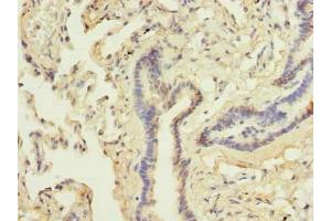 Immunohistochemistry of paraffin-embedded human lung tissue using ABIN7144990 at dilution of 1:100 (DDX42 抗体  (AA 519-819))