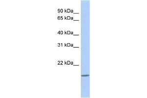 WB Suggested Anti-CLECL1 Antibody Titration: 0.