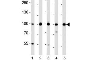 Western blot analysis of lysate from (1) MDA-MB-468, (2) SW620, (3) T47D cell line, (4) mouse spleen, (5) mouse testis tissue using EZH2 antibody at 1:1000. (EZH2 抗体)