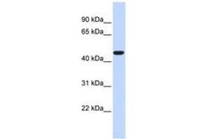Image no. 1 for anti-Acyl-CoA Thioesterase 2 (ACOT2) (AA 360-409) antibody (ABIN6740758) (ACOT2 抗体  (AA 360-409))