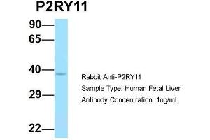 Host: Rabbit  Target Name: P2RY11  Sample Tissue: Human Fetal Liver  Antibody Dilution: 1.