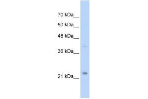 MUC1 antibody used at 2. (MUC1 抗体  (C-Term))