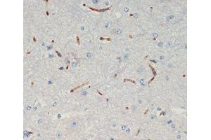 Immunohistochemistry of paraffin-embedded Mouse spinal cord using THBS1 Polyclonal Antibody at dilution of 1:200 (40x lens). (Thrombospondin 1 抗体)
