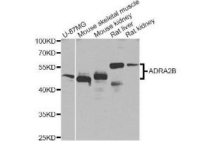 Western blot analysis of extracts of various cell lines, using ADRA2B Antibody (ABIN5996019) at 1/1000 dilution. (ADRA2B 抗体)