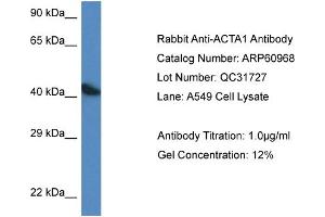 Western Blotting (WB) image for anti-Actin, alpha 1, Skeletal Muscle (ACTA1) (C-Term) antibody (ABIN786304) (Actin 抗体  (C-Term))