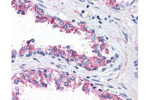 Anti-5HT1B Receptor antibody IHC of human prostate. (5HT1B Receptor 抗体  (Internal Region))