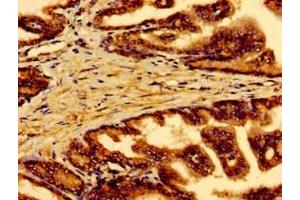 Immunohistochemistry (IHC) image for anti-RAB5A, Member RAS Oncogene Family (RAB5A) (AA 1-215) antibody (ABIN7167354)