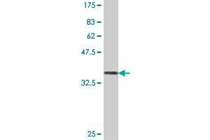 Western Blotting (WB) image for anti-Ring Finger Protein 40, E3 Ubiquitin Protein Ligase (RNF40) (AA 102-200) antibody (ABIN564227)