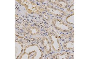 Immunohistochemistry of paraffin-embedded human kidney using ATP6AP1 antibody at dilution of 1:200 (x400 lens). (ATP6AP1 抗体  (AA 90-390))