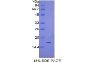 SDS-PAGE analysis of Mouse Complexin 2 Protein.