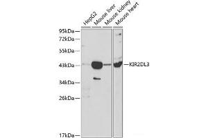 Western blot analysis of extracts of various cell lines using KIR2DL3 Polyclonal Antibody at dilution of 1:1000. (KIR2DL3 抗体)