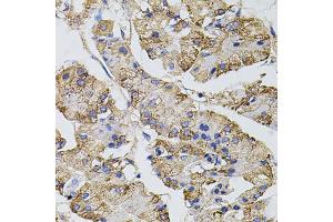 Immunohistochemistry of paraffin-embedded human stomach using CAST antibody. (Calpastatin 抗体)
