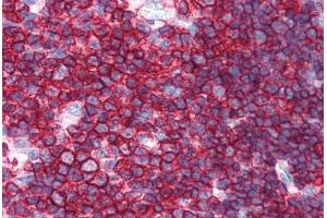 Human Thymus (formalin-fixed, paraffin-embedded) stained with SPN antibody ABIN351514 at 10 ug/ml followed by biotinylated anti-mouse IgG secondary antibody ABIN481714, alkaline phosphatase-streptavidin and chromogen. (CD43 抗体)