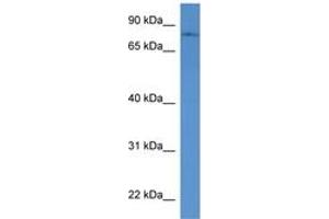 Image no. 1 for anti-Protein O-Linked Mannose Beta1,2-N-Acetylglucosaminyltransferase (POMGNT1) (AA 47-96) antibody (ABIN6746294) (POMGNT1 抗体  (AA 47-96))
