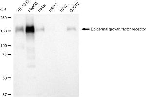 Western blotting analysis using epidermal growth factor receptor antibody (ABIN7798478). (Recombinant EGFR 抗体)
