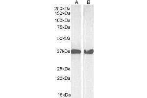Western Blotting (WB) image for anti-Glyceraldehyde-3-Phosphate Dehydrogenase (GAPDH) (Internal Region) antibody (ABIN185543)