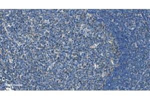 IHC analysis of IL37 using anti-IL37 antibody (ABIN7601794). (IL-37 抗体  (AA 46-218))