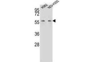 Western blot analysis in K562,NCI-H292 cell line lysates (35ug/lane) using MPP3 Antibody (C-term). (MPP3 抗体  (C-Term))