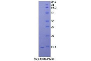 SDS-PAGE (SDS) image for Signal Transducer and Activator of Transcription 3 (Acute-Phase Response Factor) (STAT3) (AA 576-678) protein (His tag) (ABIN6239954)