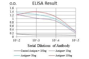 Black line: Control Antigen (100 ng), Purple line: Antigen(10 ng), Blue line: Antigen (50 ng), Red line: Antigen (100 ng), (NEFL 抗体)