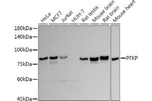 Western blot analysis of extracts of various cell lines, using PFKP antibody (ABIN7269309) at 1:1000 dilution. (PFKP 抗体)