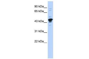 RBMXL2 antibody used at 1 ug/ml to detect target protein. (RBMXL2 抗体  (Middle Region))