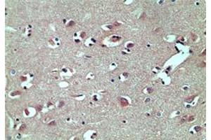 Image no. 1 for anti-TAR (HIV-1) RNA Binding Protein 2 (TARBP2) (AA 340-390) antibody (ABIN207742) (TARBP2 抗体  (AA 340-390))