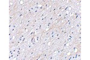 Immunohistochemical staining of human brain tissue using BAIAP3 polyclonal antibody  at 5 ug/mL . (BAIAP3 抗体  (N-Term))