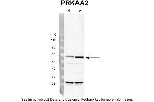 Western Blotting (WB) image for anti-Protein Kinase, AMP-Activated, alpha 2 Catalytic Subunit (PRKAA2) (Middle Region) antibody (ABIN2786849)