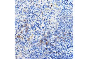 Immunohistochemistry of paraffin-embedded mouse spleen using IL24 Rabbit pAb (ABIN6128082, ABIN6142368, ABIN6142369 and ABIN6219012) at dilution of 1:100 (40x lens). (IL-24 抗体  (AA 52-140))