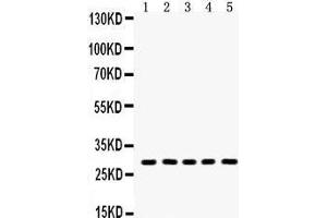 Anti- Aquaporin 1 Picoband antibody, Western blotting All lanes: Anti Aquaporin 1  at 0. (Aquaporin 1 抗体  (C-Term))