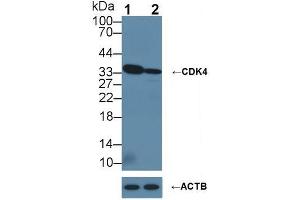 Western blot analysis of (1) Wild-type HeLa cell lysate, and (2) CDK4 knockout HeLa cell lysate, using Rabbit Anti-Human CDK4 Antibody (1 µg/ml) and HRP-conjugated Goat Anti-Mouse antibody (abx400001, 0. (CDK4 抗体  (AA 6-295))