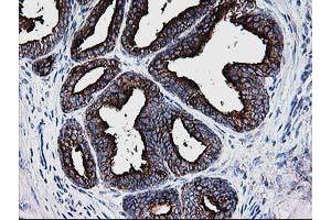 Image no. 3 for anti-Deoxythymidylate Kinase (Thymidylate Kinase) (DTYMK) antibody (ABIN1497918) (DTYMK 抗体)