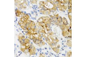 Immunohistochemistry of paraffin-embedded human stomach using GHRL antibody (ABIN6131231, ABIN6141079, ABIN6141080 and ABIN6216264) at dilution of 1:100 (40x lens). (Ghrelin 抗体  (AA 1-117))