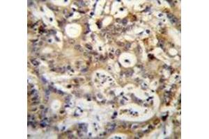 Immunohistochemistry (Paraffin-embedded Sections) (IHC (p)) image for anti-Sp1 Transcription Factor (SP1) (AA 684-715), (C-Term) antibody (ABIN954894)