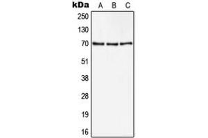Western blot analysis of CD105 expression in Hela (A), A549 (B), NIH3T3 (C) whole cell lysates. (Endoglin 抗体  (Center))
