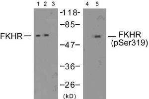 Western blot analysis of extracts from 293 cells (10% serum-treated, 15min) and HeLa cells (EGF-treated, 200ng/ml, 15min), using FKHR (Ab-319) antibody (E021161, Lane 1, 2 and 3) and FKHR (phospho-Ser319) antibody (E011136, Lane 4 and 5). (FOXO1 抗体  (pSer319))