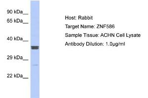 Host: Rabbit Target Name: ZNF586 Sample Type: ACHN Whole cell lysates Antibody Dilution: 1. (ZNF586 抗体  (Middle Region))