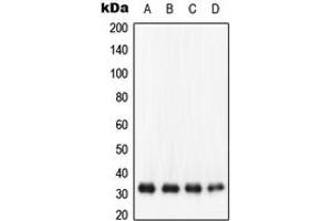 Western blot analysis of NQO1 expression in HepG2 (A), SW480 (B), HCT 116 (C), K562 (D) whole cell lysates. (NQO1 抗体  (C-Term))