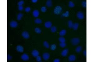 Immunofluorescent staining of human cell line. (H2AFX 抗体  (pSer139))