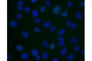 Immunofluorescent staining of human cell line.